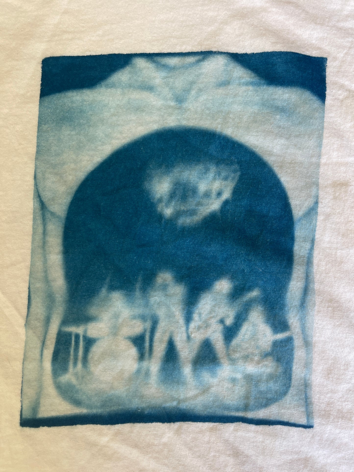 Stomach Band Misprint