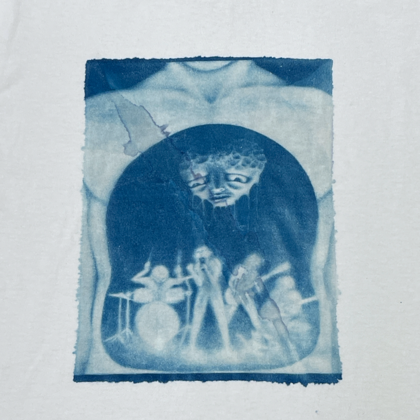 Stomach Band Misprint